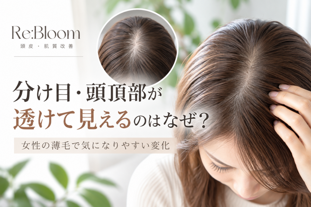 女性の分け目・頭頂部の薄毛や透け感に関する頭皮ケア