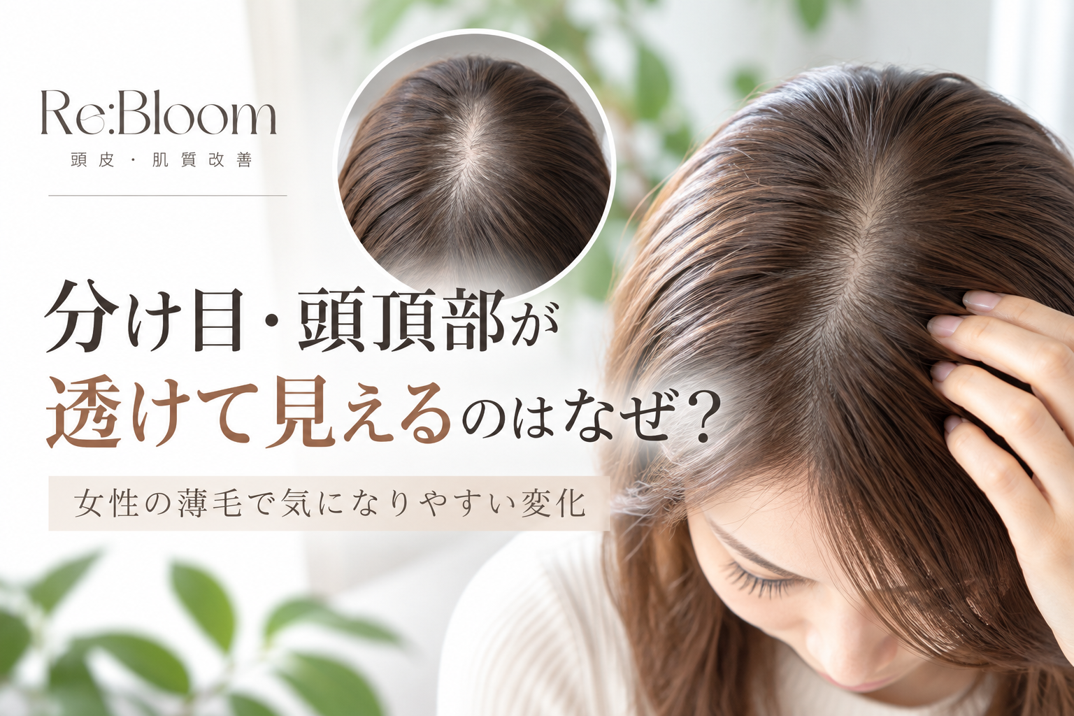 女性の分け目・頭頂部の薄毛や透け感に関する頭皮ケア