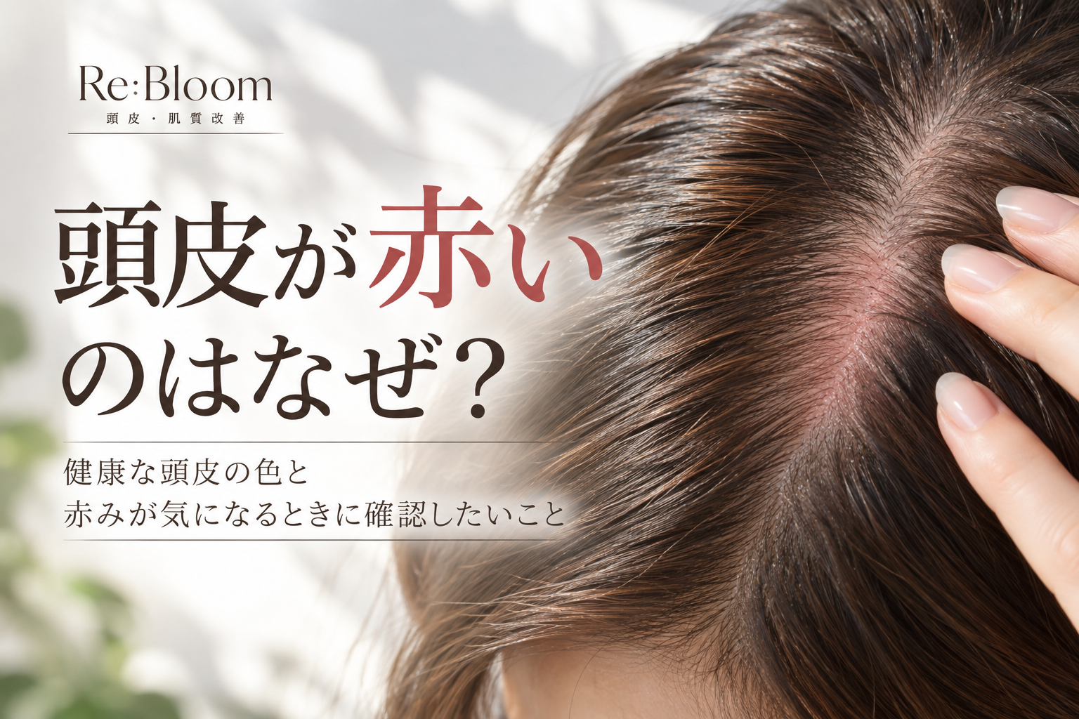 頭皮の赤みの原因や健康な頭皮の色について解説する頭皮ケア記事